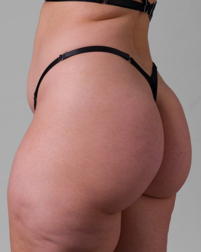 Overlay Thong